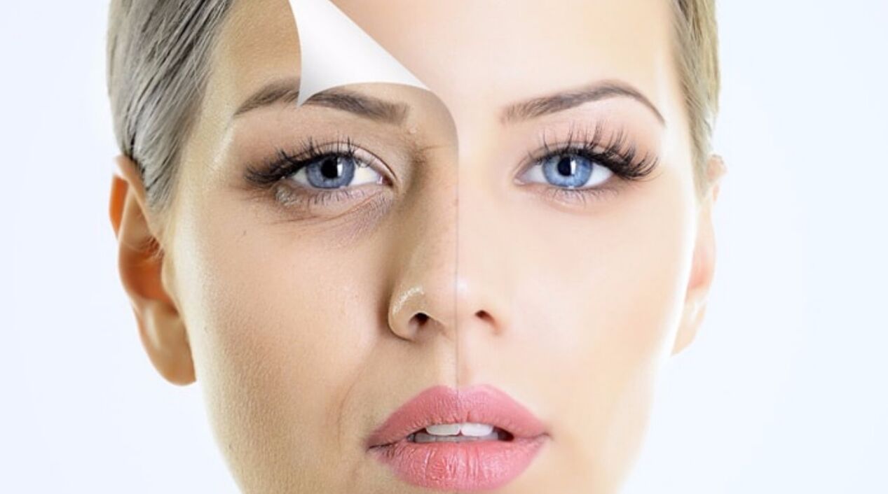 Մաշկի թարմացում Inno Gialuron կրեմով