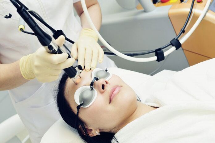 Դեմքի լազերային երիտասարդացում